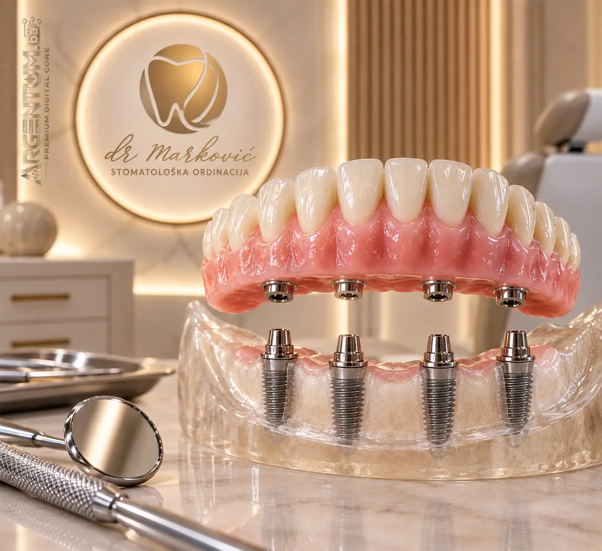 Proteza stabilizovana implantatima