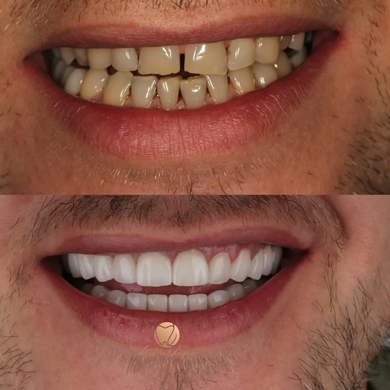 Transformacija osmijeha – fotografija 12