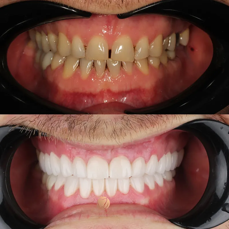 Transformacija osmijeha – fotografija 15