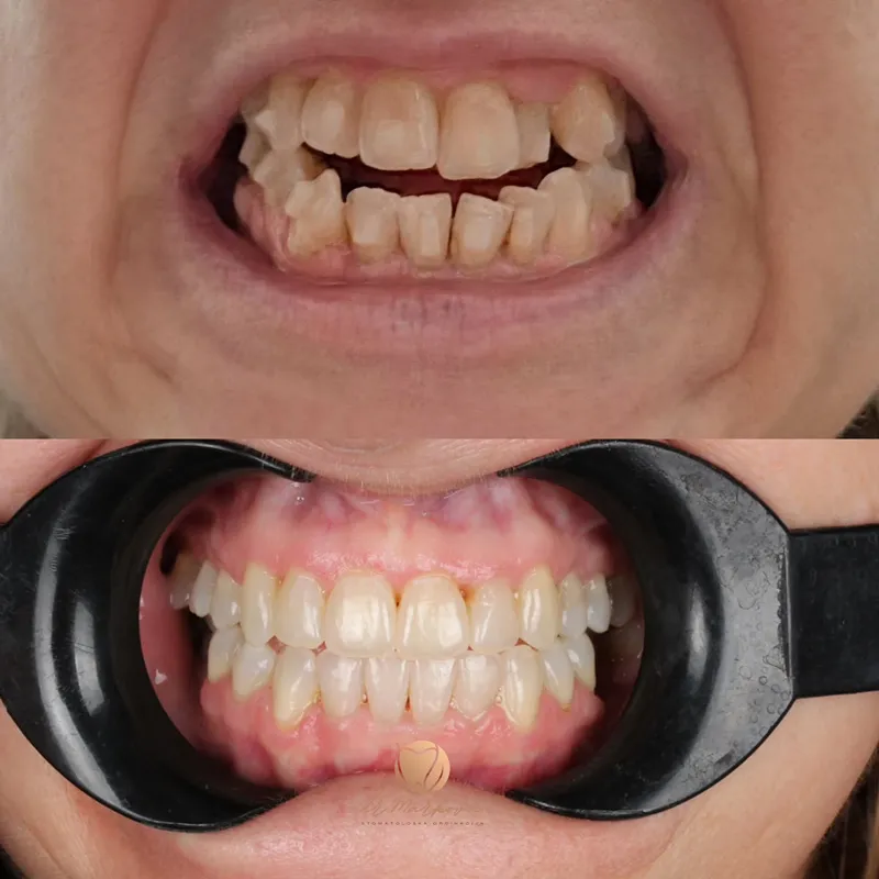 Transformacija osmijeha – fotografija 21
