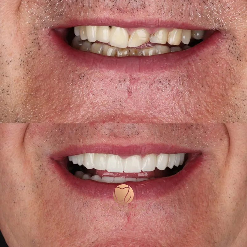 Transformacija osmijeha – fotografija 22