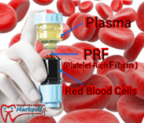 Designed by Master Design LTD. Solution by Nelle | Dizajnirao: Nelle,Master Dizajn LTD.